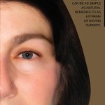 Facelift – Erasing Years Off Your Face