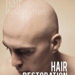 Hair Restoration – Restoring What You Have Lost