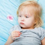 Chickenpox_How_to_Ease_the_Itch