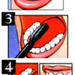 oral