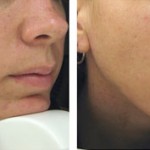 Aging and Plastic surgery through the decades
