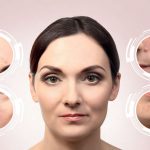 acne-facial-zones