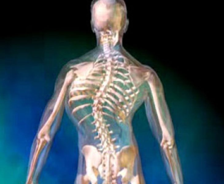 30% of Scoliosis Surgeries in the UAE are Revision Cases to Operations Performed Abroad