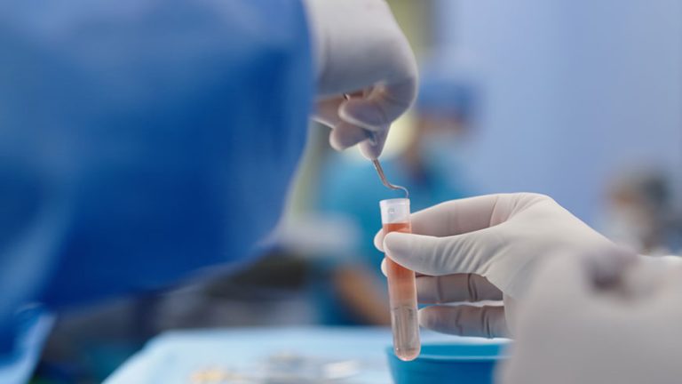 Abu Dhabi Stem Cells Center Performs Testicular Cryopreservation for 4 Young Boys Prior to Undergoing Bone Marrow Transplantation